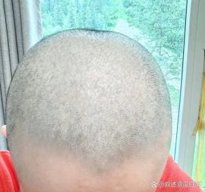 漂亮大学女生剃光头故事_95后女大学生支教剃光头，女孩失恋剪短发，勇敢改变活出自我