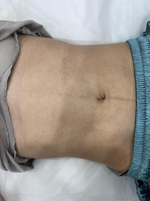 女性肚子图片_女性腹部构造图解，助你直观了解腹肌和器官位置！